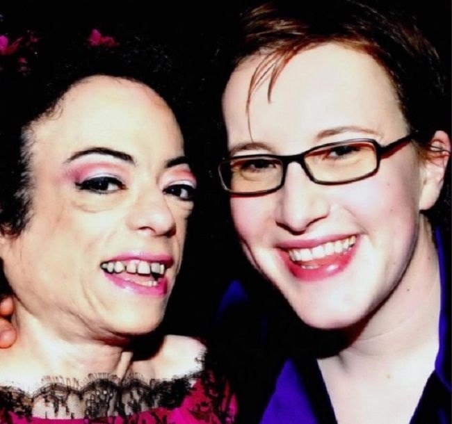 Is Liz Carr married in real life? - ABTC