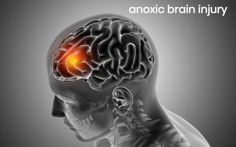 is-anoxic-brain-damage-permanent-abtc