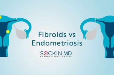 How Can I Treat Fibroids And Endometriosis Without Surgery? - ABTC