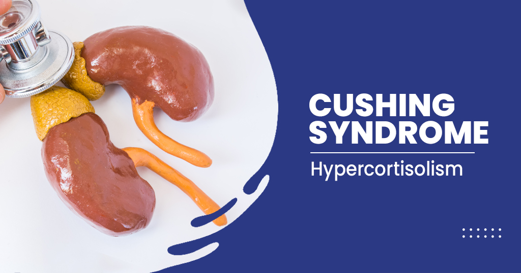 What are the 4 underlying causes of Cushing's syndrome? ABTC