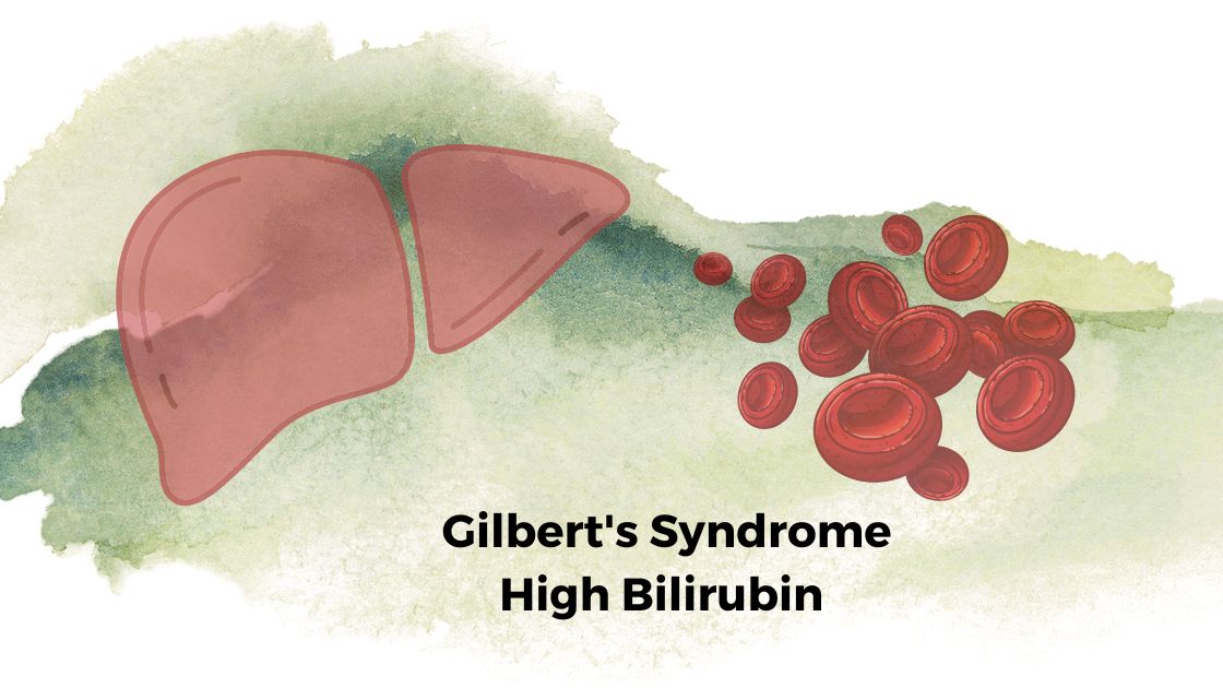 What does Gilbert's syndrome cause? - ABTC